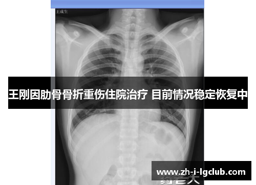 王刚因肋骨骨折重伤住院治疗 目前情况稳定恢复中 王刚因肋骨骨折重伤住院治疗 目前情况稳定恢复中